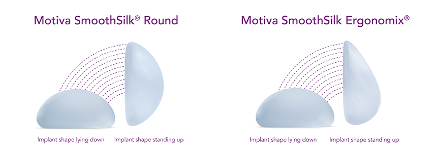 Motiva Smooth Silk implants compared